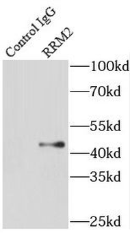 RRM2 Rabbit Polyclonal Antibody