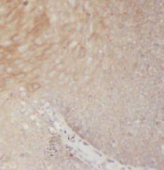 RRM2 Rabbit Polyclonal Antibody
