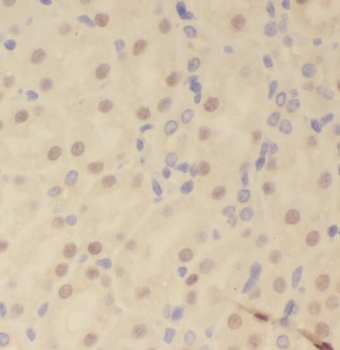 RPS6KA3 Antibody