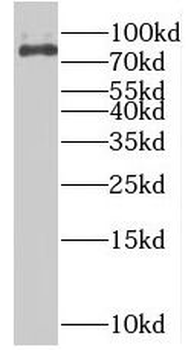 RPS6KA2 Rabbit Polyclonal Antibody