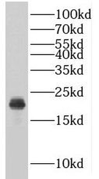RSL24D1 Rabbit Polyclonal Antibody