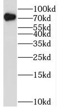 RUNX1T1 Rabbit Polyclonal Antibody