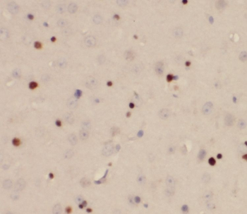 RUNX1T1 Rabbit Polyclonal Antibody