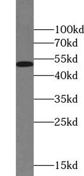 RXRA Rabbit Polyclonal Antibody