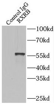 RXRB Rabbit Polyclonal Antibody
