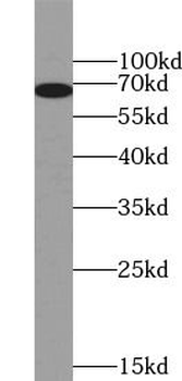 RYK Rabbit Polyclonal Antibody