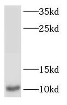 S100A6 Rabbit Polyclonal Antibody