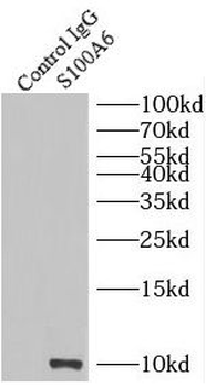 S100A6 Rabbit Polyclonal Antibody