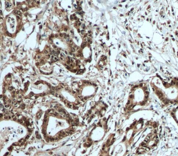 S100A6 Rabbit Polyclonal Antibody