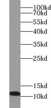 S100A8 Rabbit Polyclonal Antibody