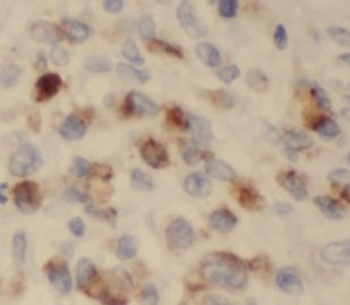 S100A8 Rabbit Polyclonal Antibody