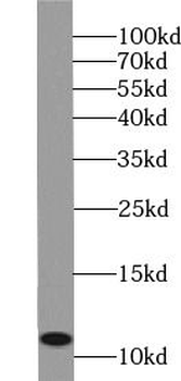 S100B Antibody