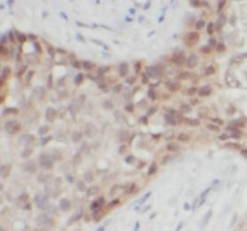 S100B Antibody