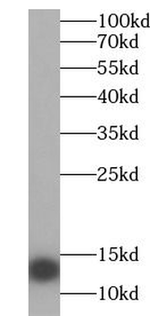 SAA2 Antibody
