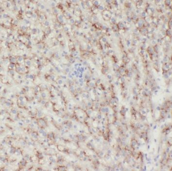 SAA4 Antibody