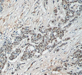 SAE1 Antibody