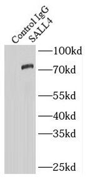 SALL4 Rabbit Polyclonal Antibody