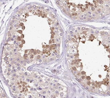 SALL4 Rabbit Polyclonal Antibody