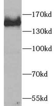 SALL4 Mouse Monoclonal Antibody