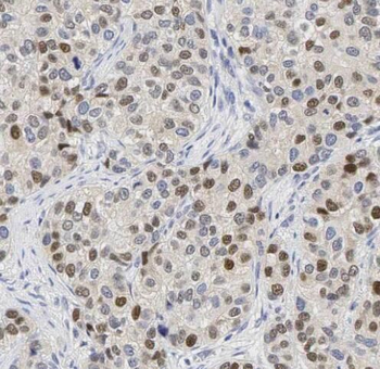 KHDRBS1 Antibody