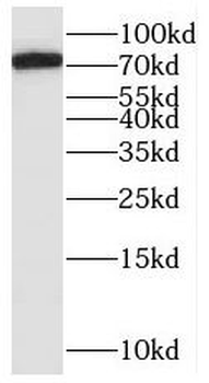SAMD4B Rabbit Polyclonal Antibody