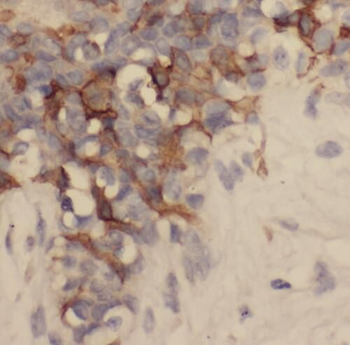 SAMD9L Rabbit Polyclonal Antibody