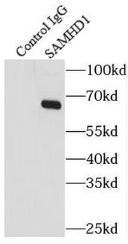 SAMHD1 Antibody