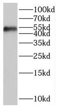 SAMM50 Rabbit Polyclonal Antibody