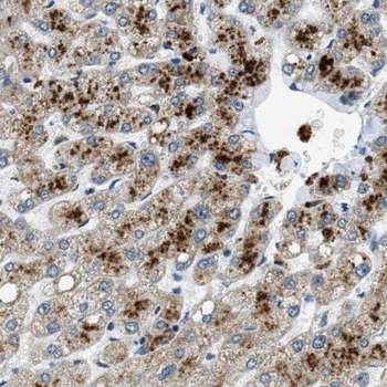 SAMM50 Rabbit Polyclonal Antibody