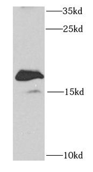 SAP18 Rabbit Polyclonal Antibody