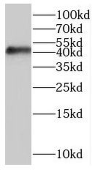 MAPK13 Rabbit Polyclonal Antibody