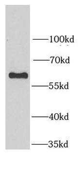 SARS1 Rabbit Polyclonal Antibody