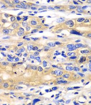 SARS1 Rabbit Polyclonal Antibody