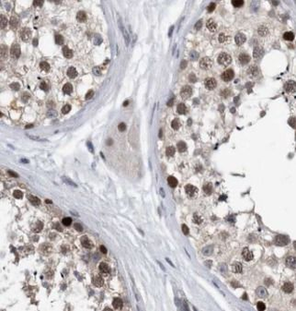 SART3 Rabbit Polyclonal Antibody
