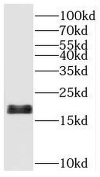 SAT2 Rabbit Polyclonal Antibody