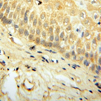SAT2 Rabbit Polyclonal Antibody