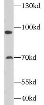 SATB2 Rabbit Polyclonal Antibody