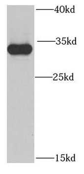 SBDS Rabbit Polyclonal Antibody