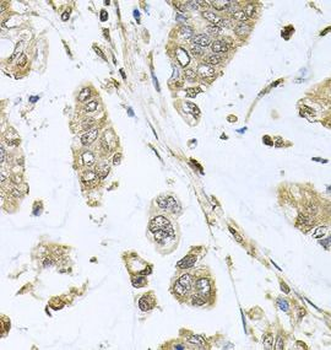 SBDS Rabbit Polyclonal Antibody