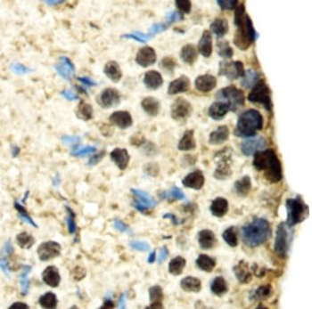 SBNO1 Antibody