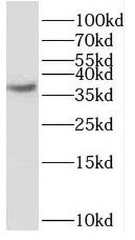 SCAMP1 Rabbit Polyclonal Antibody