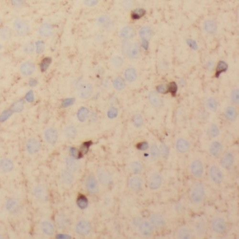 SCAMP1 Rabbit Polyclonal Antibody