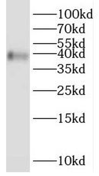 SCAMP2 Rabbit Polyclonal Antibody