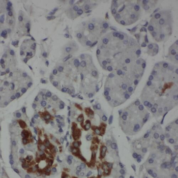 SCAMP2 Rabbit Polyclonal Antibody