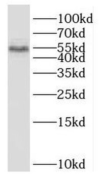 SCHIP1 Rabbit Polyclonal Antibody