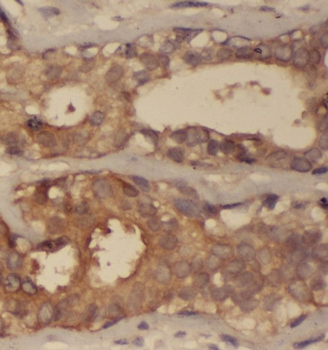 SCLY Rabbit Polyclonal Antibody