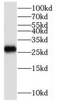 SCO2 Rabbit Polyclonal Antibody
