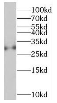 SYCP3 Antibody