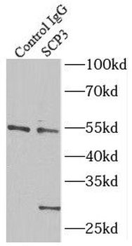 SYCP3 Antibody