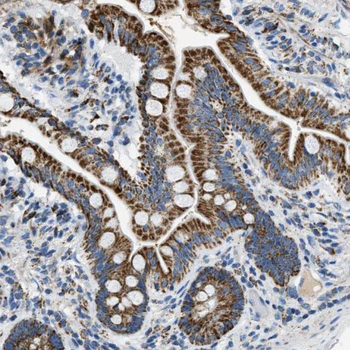 SDF4 Rabbit Polyclonal Antibody